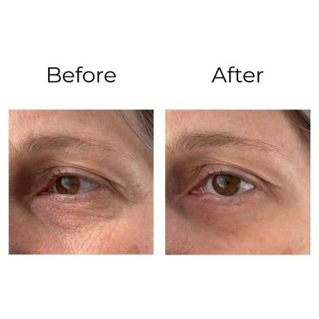Peptilux - Crème anti-rides pour les yeux à effet « shock action » avec LIPHASYN™ - 20 ml Cod.: LUX001