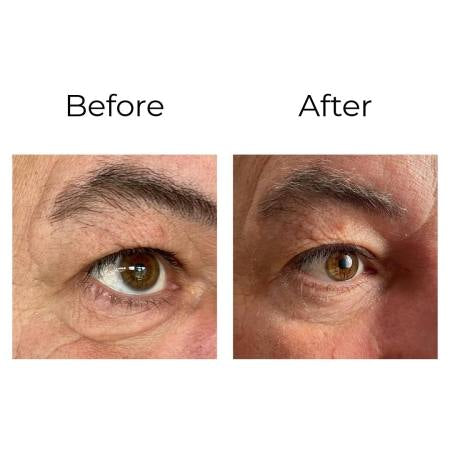 Peptilux - Crème anti-rides pour les yeux à effet « shock action » avec LIPHASYN™ - 20 ml Cod.: LUX001